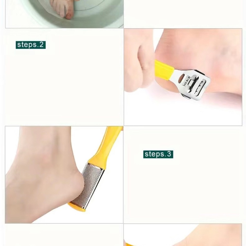 Callus Remover Kit - Picture 12 of 16